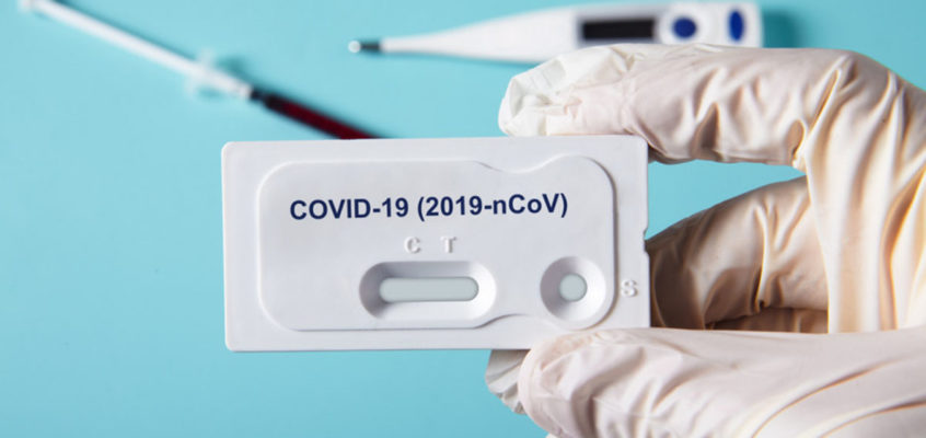 Włochy: do końca roku niemal co trzecia osoba będzie miała zrobiony test na koronawirusa